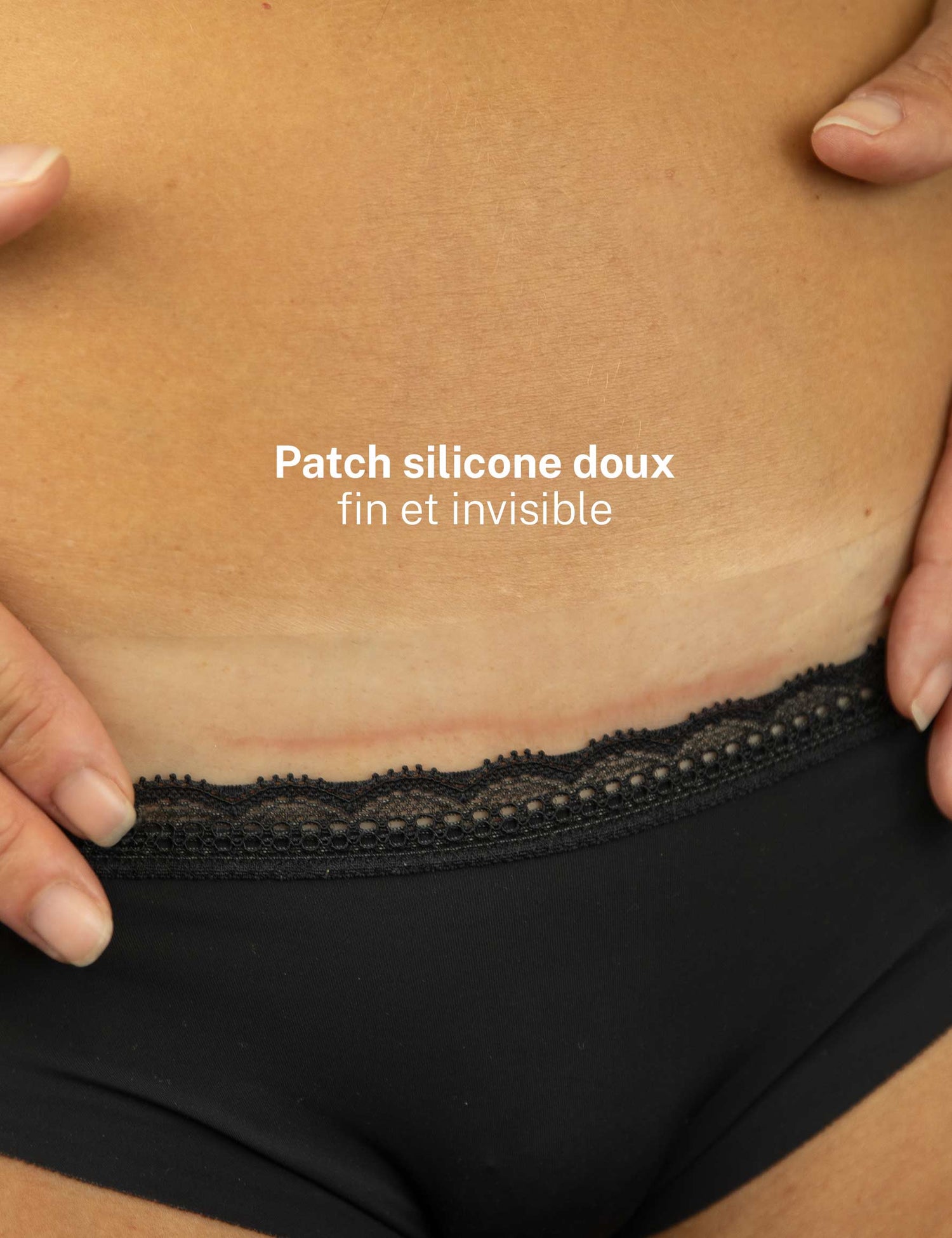 Patch médical siliconé